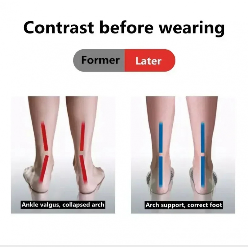 2 Pcs EVA Flat Feet Arch Suppo - مراجعة Men Shoes Outlet وسعره
